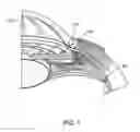 Fig. 02 - Glaucoma treatment device