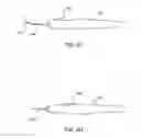 Fig. 09 - Glaucoma treatment device