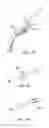 Fig. 18 - Glaucoma treatment device