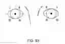 Fig. 33 - Glaucoma treatment device