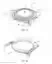 Fig. 02 - Apparatus and methods for treating excess intraocular fluid