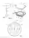 Fig. 07 - Apparatus and methods for treating excess intraocular fluid