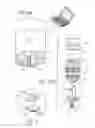 Fig. 08 - Apparatus and methods for treating excess intraocular fluid