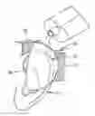 Fig. 01 - Method and apparatus for correcting auricular deformities