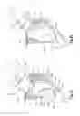 Fig. 02 - Method and apparatus for correcting auricular deformities