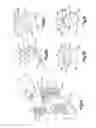 Fig. 04 - Method and apparatus for correcting auricular deformities