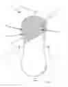 Fig. 02 - HETEROGENOUS MASS CONTAINING FOAM