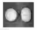 Fig. 01 - Tamper resistant dosage forms