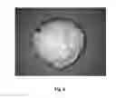 Fig. 09 - Tamper resistant dosage forms