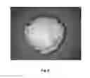 Fig. 09 - Tamper resistant dosage forms