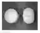 Fig. 01 - Tamper resistant dosage forms