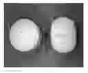 Fig. 01 - Tamper resistant dosage forms