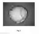 Fig. 09 - Tamper resistant dosage forms