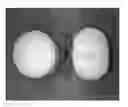 Fig. 01 - Tamper resistant dosage forms