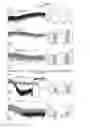 Fig. 03 - Uses of ganaxolone