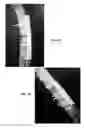 Fig. 02 - Formulation for regeneration of bone, cartilage, teeth, and periodontium and treatment of tumors and cysts