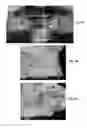 Fig. 03 - Formulation for regeneration of bone, cartilage, teeth, and periodontium and treatment of tumors and cysts