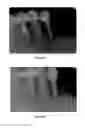 Fig. 06 - Formulation for regeneration of bone, cartilage, teeth, and periodontium and treatment of tumors and cysts
