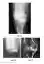Fig. 07 - Formulation for regeneration of bone, cartilage, teeth, and periodontium and treatment of tumors and cysts