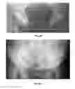 Fig. 08 - Formulation for regeneration of bone, cartilage, teeth, and periodontium and treatment of tumors and cysts