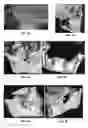 Fig. 09 - Formulation for regeneration of bone, cartilage, teeth, and periodontium and treatment of tumors and cysts