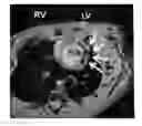Fig. 01 - Methods and materials for reducing organ transplant rejection or ischemic/reperfusion injury in a subject
