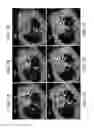 Fig. 02 - Methods and materials for reducing organ transplant rejection or ischemic/reperfusion injury in a subject