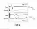 Fig. 03 - Treatment of inflammatory diseases