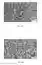 Fig. 07 - ORTHOPEDIC USE OF A HYDROGEL COMPOSITION