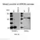 Fig. 07 - Use of SLURP1 as an imunomodulatory molecule in the ocular surface