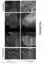 Fig. 06 - Methods and compositions for treating Huntington's Disease