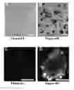 Fig. 07 - Nanoparticle therapy in cancer