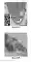 Fig. 09 - Nanoparticle therapy in cancer