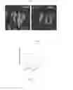 Fig. 02 - Use of a photosensitive agent capable of producing reactive oxygen species in the production of a drug for the photodynamic therapy of a disease related to stem cells, in vitro use, and pharmaceutical composition