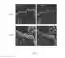Fig. 06 - Use of a photosensitive agent capable of producing reactive oxygen species in the production of a drug for the photodynamic therapy of a disease related to stem cells, in vitro use, and pharmaceutical composition