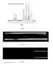 Fig. 06 - Method of embolization using a radiopaque, non-biodegradable, water-insoluble iodinated benzyl ether of polyl(vinyl alcohol)