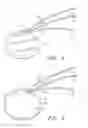 Fig. 02 - Extracellular Matrix Encasement Structures and Methods