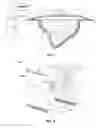 Fig. 02 - Thin film wound dressing