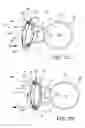 Fig. 09 - Ventricular cuff