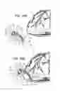Fig. 13 - Ventricular cuff