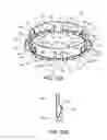 Fig. 16 - Ventricular cuff