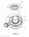 Fig. 29 - Ventricular cuff