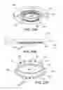 Fig. 30 - Ventricular cuff