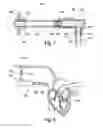 Fig. 08 - Pump, system with a blood pump and method for producing a blood pump