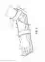 Fig. 06 - ARM RESTRAINT FOR IV SITE STABILITY