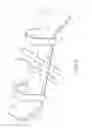 Fig. 07 - ARM RESTRAINT FOR IV SITE STABILITY