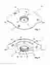 Fig. 02 - Tracheostoma plaster
