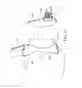 Fig. 35 - Patient interface