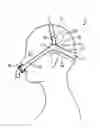 Fig. 01 - AUTO-ADJUSTING HEADGEAR FOR A PATIENT INTERFACE DEVICE