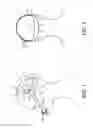 Fig. 02 - AUTO-ADJUSTING HEADGEAR FOR A PATIENT INTERFACE DEVICE